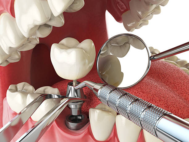 Best Urgent Tooth Repair  in Franklin Park, FL