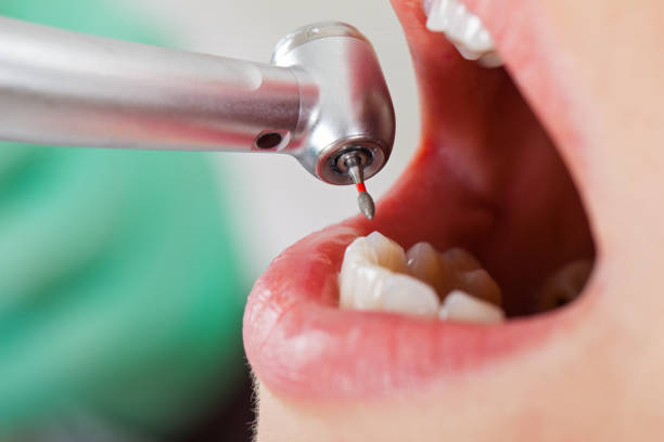 Best Root Canal Emergency Dentist  in Franklin Park, FL
